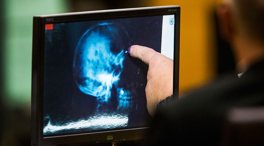 Une nouvelle recherche a démontré qu'il est possible de "fermer" (shutdown) certaines zones du cerveau, en utilisant la stimulation magnétique trans-crânienne, de façon à "réduire" les croyances religieuses/spirituelles et à atténuer les préjugés/opinions critiques
